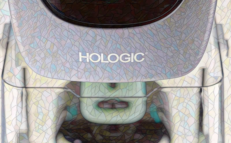 Hologic's Fiscal Q1 2023 Earnings: A Ray of Hope in a Stormy Year